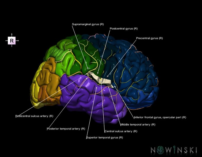 G8.T3.1-6_6.23-13.4-15.2.V8.C2.L1.Cerebrum-No_subcentral_gyrus_right-WM-Intracranial_arteries.tiff