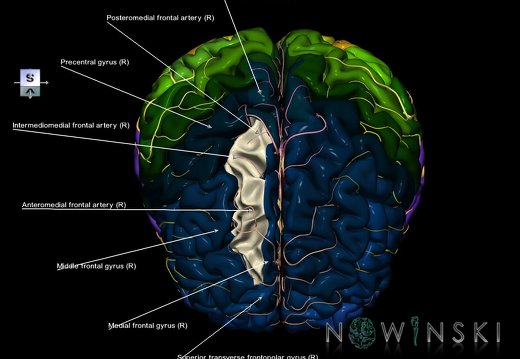 G8.T3.1-6 6.24-13.4-15.2.V8.C2.L1.Cerebrum-No sup frontal gyrus right-WM-Intracranial arteries
