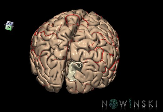 G8.T3.1-6 6.25-13.4-15.2.V8.C1.L0.Cerebrum-No sup occipital gyrus right-WM-Intracranial arteries