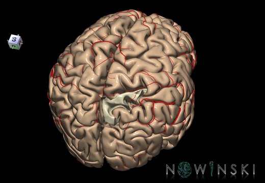 G8.T3.1-6 6.26-13.4-15.2.V8.C1.L0.Cerebrum-No sup parietal lobule right-WM-Intracranial arteries