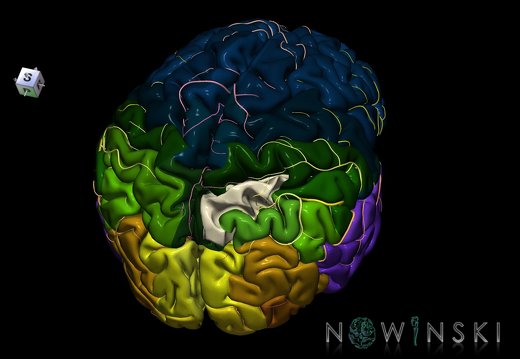 G8.T3.1-6 6.26-13.4-15.2.V8.C2.L0.Cerebrum-No sup parietal lobule right-WM-Intracranial arteries
