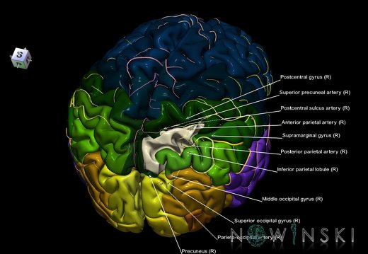 G8.T3.1-6 6.26-13.4-15.2.V8.C2.L1.Cerebrum-No sup parietal lobule right-WM-Intracranial arteries