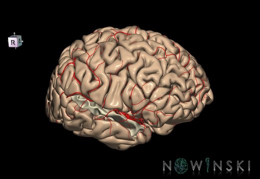G8.T3.1-6 6.27-13.4-15.2.V8.C1.L0.Cerebrum-No sup temporal gyrus right-WM-Intracranial arteries