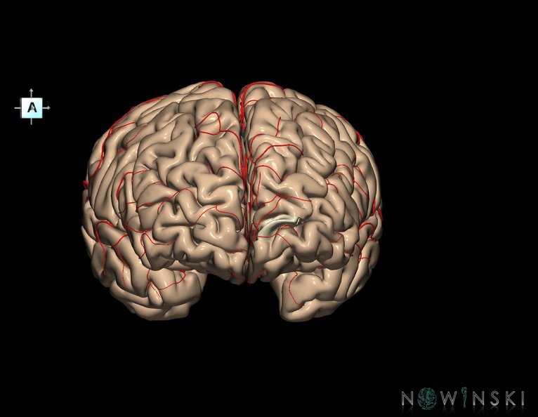G8.T3.1-6_6.29.2-13.4-15.2.V7.C1.L0.Cerebrum-No_inf_trans_frontopolar_gyrus_left-WM-Intracranial_arteries.tiff