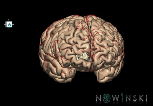 G8.T3.1-6 6.29.2-13.4-15.2.V8.C1.L0.Cerebrum-No inf trans frontopolar gyrus right-WM-Intracranial arteries