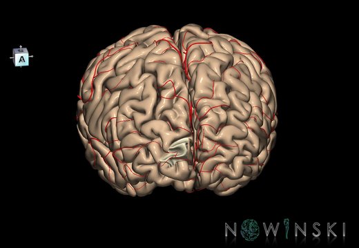 G8.T3.1-6 6.29.3-13.4-15.2.V8.C1.L0.Cerebrum-No sup trans frontopolar gyrus right-WM-Intracranial arteries