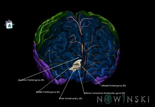 G8.T3.1-6 6.29.3-13.4-15.2.V8.C2.L1.Cerebrum-No sup trans frontopolar gyrus right-WM-Intracranial arteries