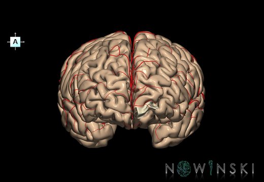 G8.T3.1-6 6.4-13.4-15.2.V1.C1.L0.Cerebrum-No frontomarginal gyrus left-WM-Intracranial arteries