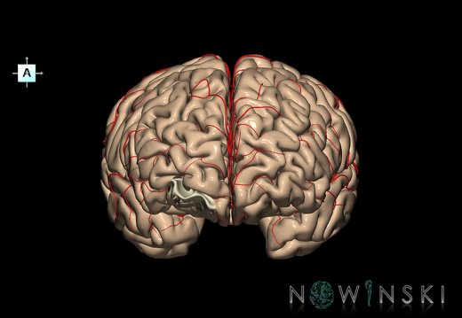 G8.T3.1-6 6.4-13.4-15.2.V1.C1.L0.Cerebrum-No frontomarginal gyrus right-WM-Intracranial arteries