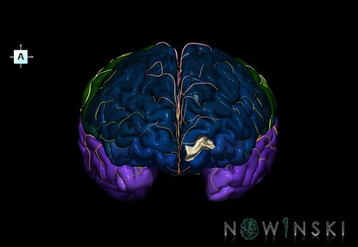 G8.T3.1-6 6.4-13.4-15.2.V1.C2.L0.Cerebrum-No frontomarginal gyrus left-WM-Intracranial arteries