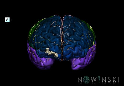 G8.T3.1-6 6.4-13.4-15.2.V1.C2.L0.Cerebrum-No frontomarginal gyrus right-WM-Intracranial arteries