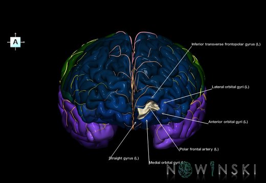 G8.T3.1-6 6.4-13.4-15.2.V1.C2.L1.Cerebrum-No frontomarginal gyrus left-WM-Intracranial arteries