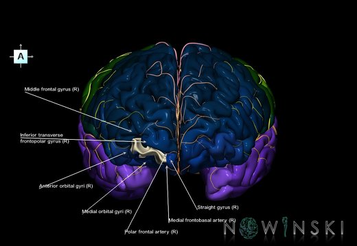 G8.T3.1-6 6.4-13.4-15.2.V1.C2.L1.Cerebrum-No frontomarginal gyrus right-WM-Intracranial arteries