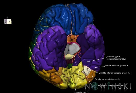G8.T3.1-6 6.5.1-13.4-15.2.V7.C2.L1.Cerebrum-No fusiform gyrus occ left-WM-Intracranial arteries