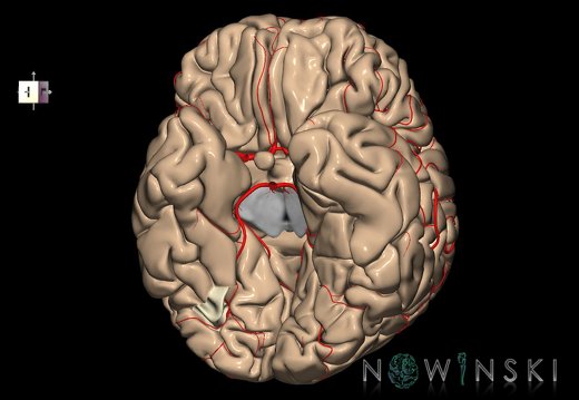 G8.T3.1-6 6.5.1-13.4-15.2.V8.C1.L0.Cerebrum-No fusiform gyrus occ right-WM-Intracranial arteries