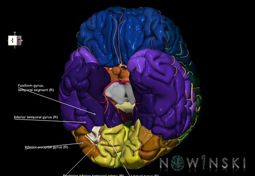 G8.T3.1-6 6.5.1-13.4-15.2.V8.C2.L1.Cerebrum-No fusiform gyrus occ right-WM-Intracranial arteries