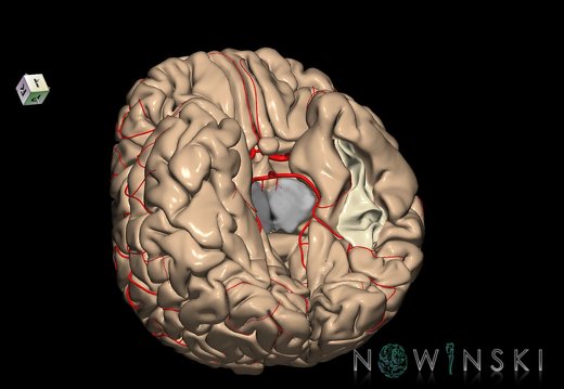 G8.T3.1-6 6.5.2-13.4-15.2.V7.C1.L0.Cerebrum-No fusiform gyrus temp left-WM-Intracranial arteries