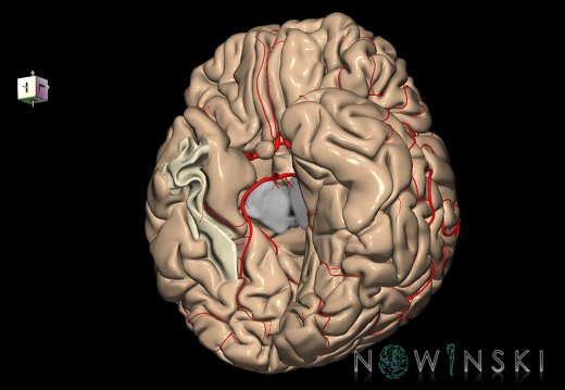 G8.T3.1-6 6.5.2-13.4-15.2.V8.C1.L0.Cerebrum-No fusiform gyrus temp right-WM-Intracranial arteries