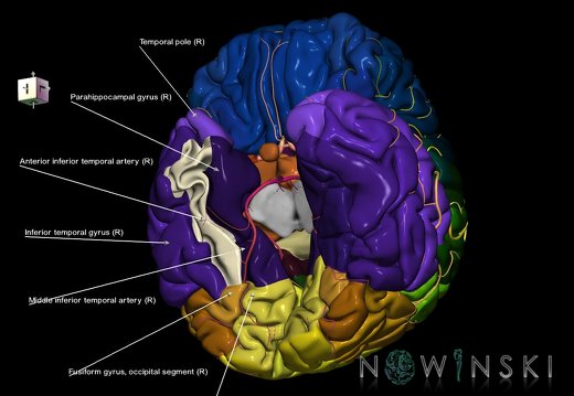 G8.T3.1-6 6.5.2-13.4-15.2.V8.C2.L1.Cerebrum-No fusiform gyrus temp right-WM-Intracranial arteries