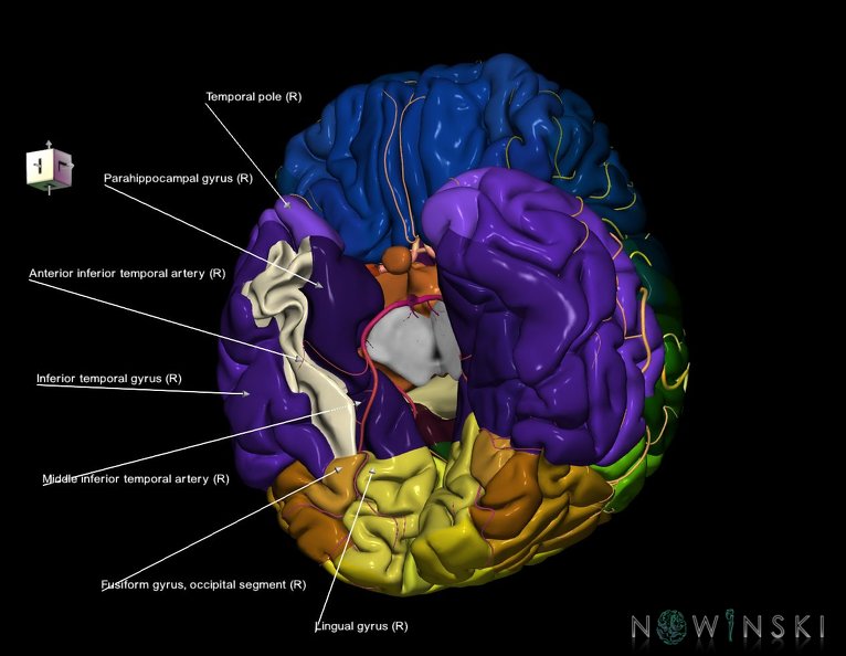 G8.T3.1-6_6.5.2-13.4-15.2.V8.C2.L1.Cerebrum-No_fusiform_gyrus_temp_right-WM-Intracranial_arteries.tiff