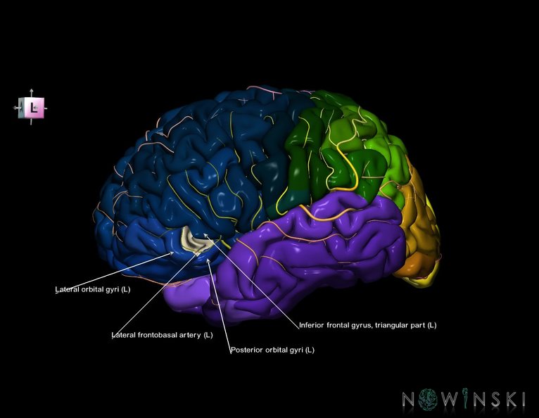 G8.T3.1-6_6.6.3-13.4-15.2.V7.C2.L1.Cerebrum-No_inf_frontal_gyrus_or_left-WM-Intracranial_arteries.tiff