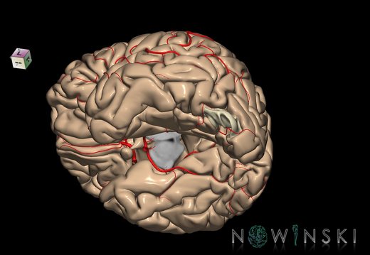 G8.T3.1-6 6.7-13.4-15.2.V7.C1.L0.Cerebrum-No inf occipital gyrus left-WM-Intracranial arteries