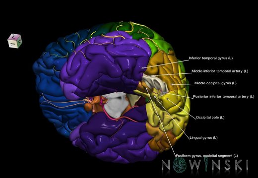 G8.T3.1-6 6.7-13.4-15.2.V7.C2.L1.Cerebrum-No inf occipital gyrus left-WM-Intracranial arteries