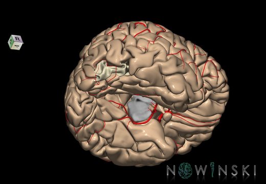 G8.T3.1-6 6.7-13.4-15.2.V8.C1.L0.Cerebrum-No inf occipital gyrus right-WM-Intracranial arteries