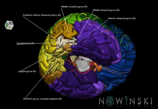 G8.T3.1-6 6.7-13.4-15.2.V8.C2.L1.Cerebrum-No inf occipital gyrus right-WM-Intracranial arteries