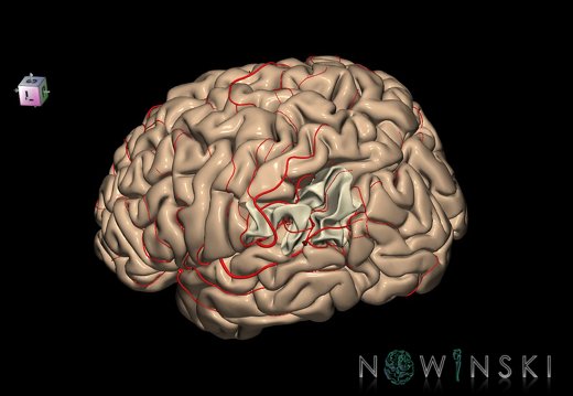 G8.T3.1-6 6.8-13.4-15.2.V7.C1.L0.Cerebrum-No inf parietal lobule left-WM-Intracranial arteries