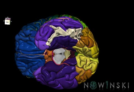 G8.T3.1-6 6.9-13.4-15.2.V7.C2.L0.Cerebrum-No inf temporal gyrus left-WM-Intracranial arteries