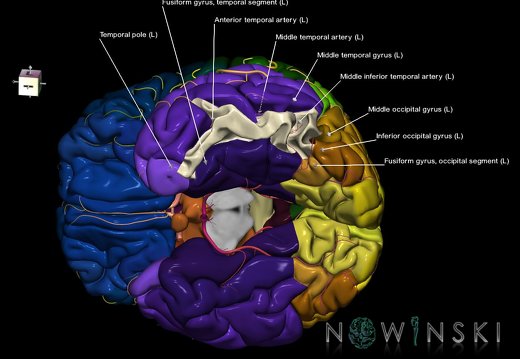 G8.T3.1-6 6.9-13.4-15.2.V7.C2.L1.Cerebrum-No inf temporal gyrus left-WM-Intracranial arteries