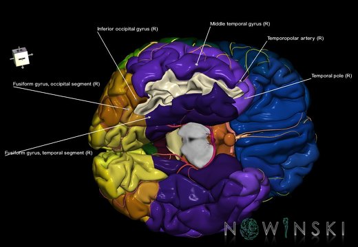 G8.T3.1-6 6.9-13.4-15.2.V8.C2.L1.Cerebrum-No inf temporal gyrus right-WM-Intracranial arteries