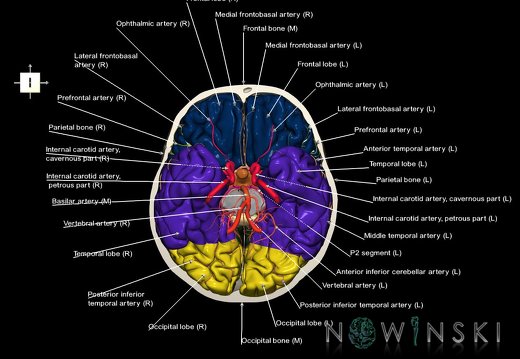 G8.T3.1-15.2-22.2 22.3.V6.C2.L1.Cerebrum-Intracranial arteries-Neurocranium-No skull base