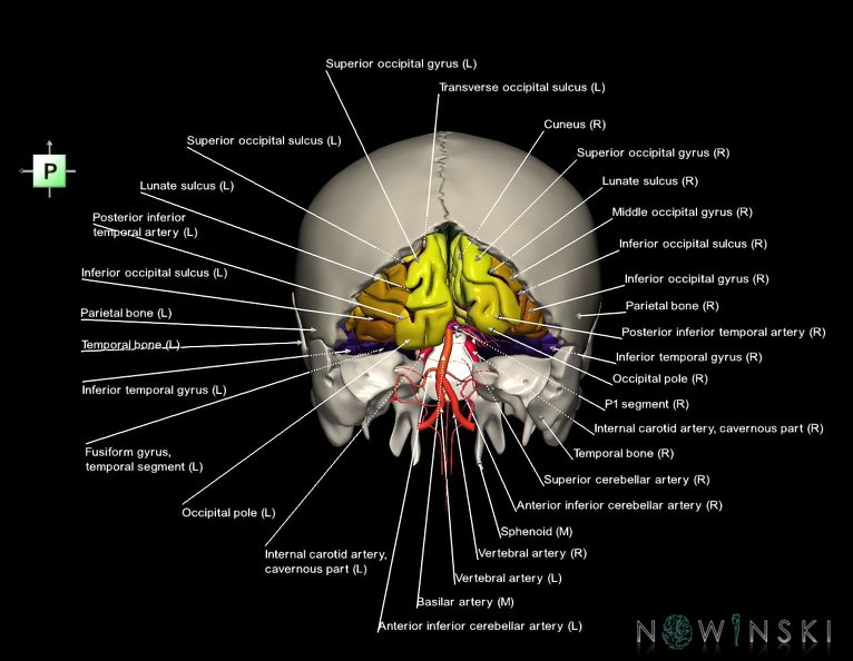 G8.T3.1-15.2-22.2_22.5.6.V3.C4-2.L1.Cerebrum-Intracranial_arteries-Neurocranium-No_occipital_bone.tiff