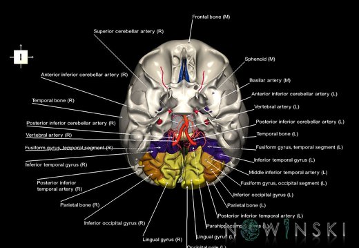 G8.T3.1-15.2-22.2 22.5.6.V6.C3-2.L1.Cerebrum-Intracranial arteries-Neurocranium-No occipital bone