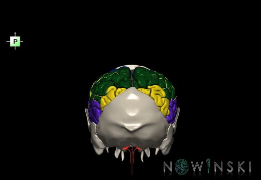 G8.T3.1-22.2 22.5.7.V3.C2.L0.Cerebrum-Neurocranium-No parietal bone