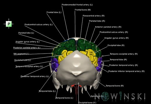 G8.T3.1-22.2 22.5.7.V3.C2.L1.Cerebrum-Neurocranium-No parietal bone
