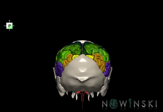 G8.T3.1-22.2 22.5.7.V3.C3-2.L0.Cerebrum-Neurocranium-No parietal bone