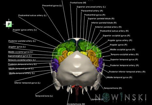 G8.T3.1-22.2 22.5.7.V3.C3-2.L1.Cerebrum-Neurocranium-No parietal bone