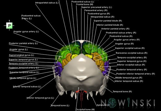 G8.T3.1-22.2 22.5.7.V3.C4-2.L1.Cerebrum-Neurocranium-No parietal bone