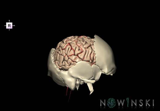 G8.T3.1-22.2 22.5.7.V4.C1.L0.Cerebrum-Neurocranium-No parietal bone