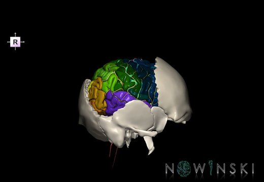 G8.T3.1-22.2 22.5.7.V4.C4-2.L0.Cerebrum-Neurocranium-No parietal bone