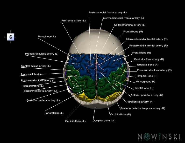 G8.T3.1-22.2_22.5.7.V5.C2.L1.Cerebrum-Neurocranium-No_parietal_bone.tiff