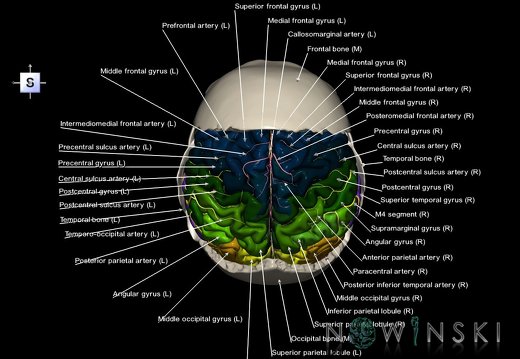 G8.T3.1-22.2 22.5.7.V5.C3-2.L1.Cerebrum-Neurocranium-No parietal bone