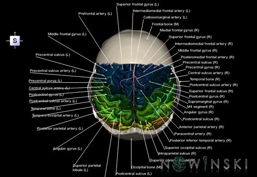 G8.T3.1-22.2 22.5.7.V5.C4-2.L1.Cerebrum-Neurocranium-No parietal bone