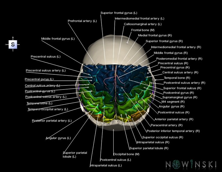 G8.T3.1-22.2_22.5.7.V5.C4-2.L1.Cerebrum-Neurocranium-No_parietal_bone.tiff