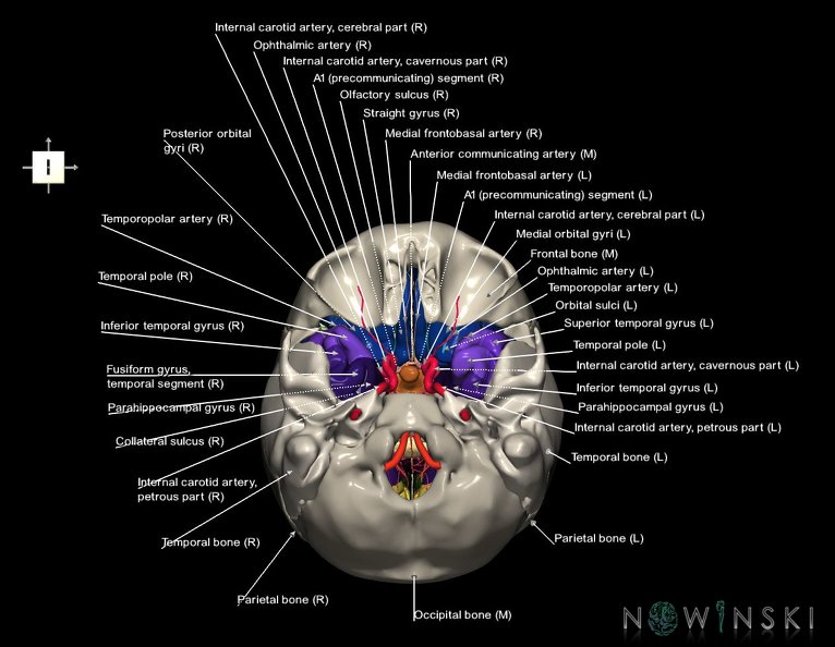 G8.T3.1-15.2-22.2_22.5.8.V6.C4-2.L1.Cerebrum-Intracranial_arteries-Neurocranium-No_sphenoid.tiff