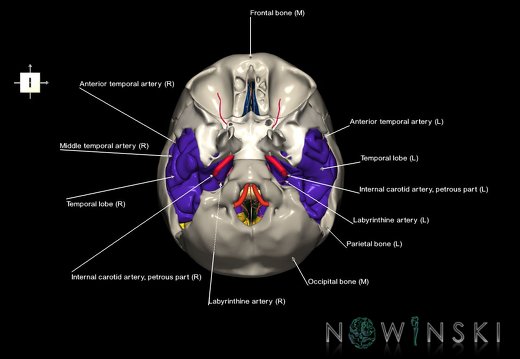 G8.T3.1-15.2-22.2 22.5.9.V6.C2.L1.Cerebrum-Intracranial arteries-Neurocranium-No temporal bone