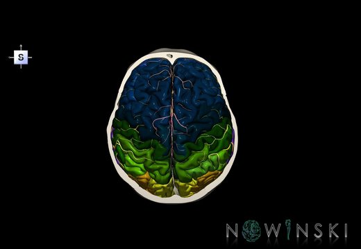 G8.T3.1-15.2-22.2 22.6.V5.C3-2.L0.Cerebrum-Intracranial arteries-Neurocranium-No skull top